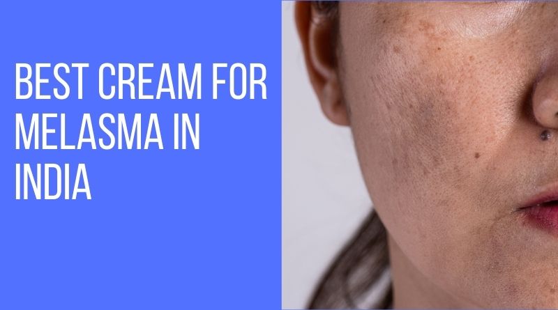 Best Cream for Melasma in India