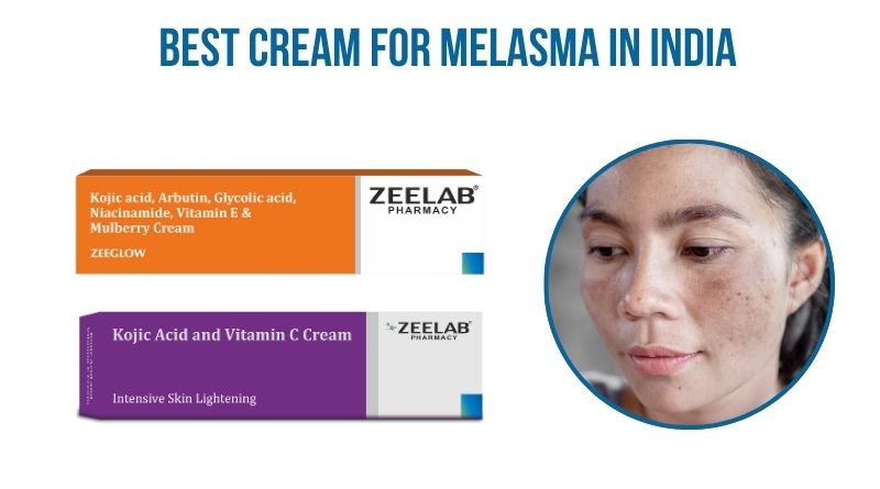 Best Cream for Melasma in India