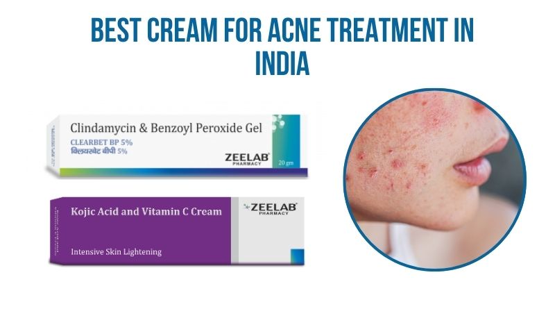 Best Cream for Acne Treatment in India