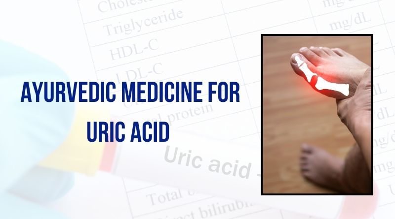  Ayurvedic Medicine for Uric Acid​