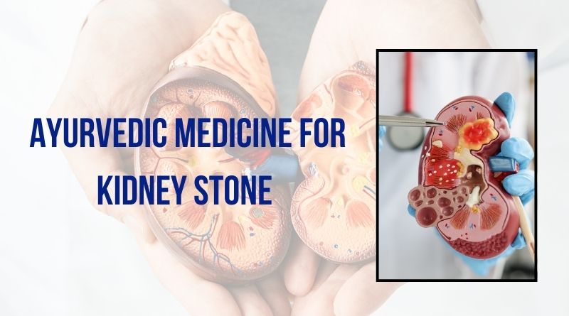 Ayurvedic Medicine for Kidney Stone​