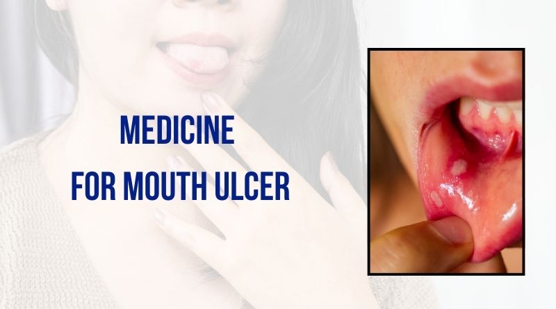 Medicine for Mouth Ulcer