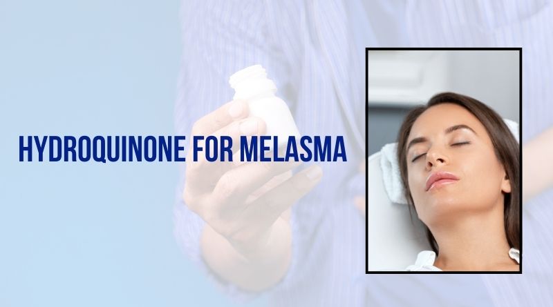 Hydroquinone For Melasma