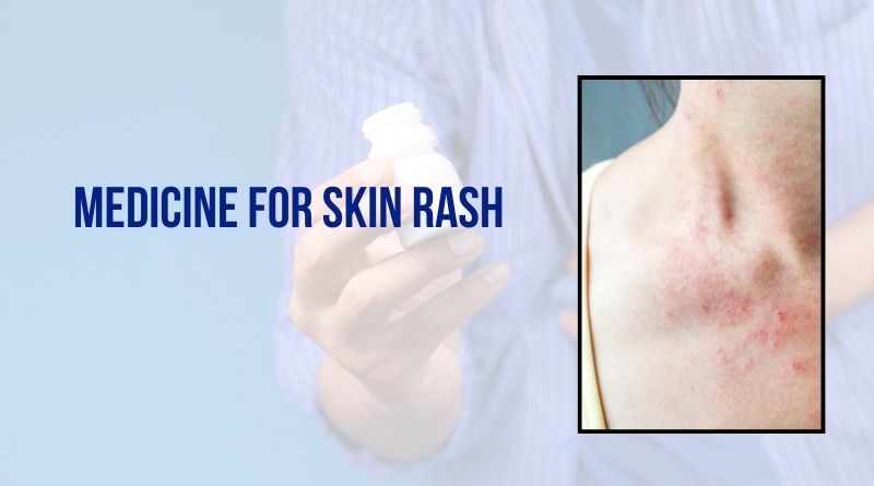 Medicine For Skin Rash