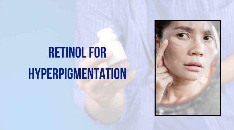 Retinol for Hyperpigmentation