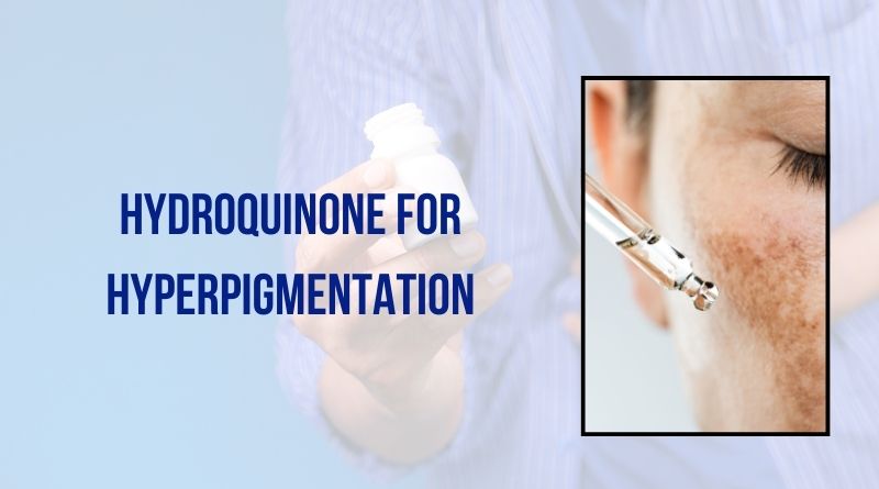 Hydroquinone For Hyperpigmentation