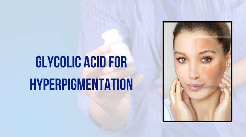 Glycolic Acid For Hyperpigmentation