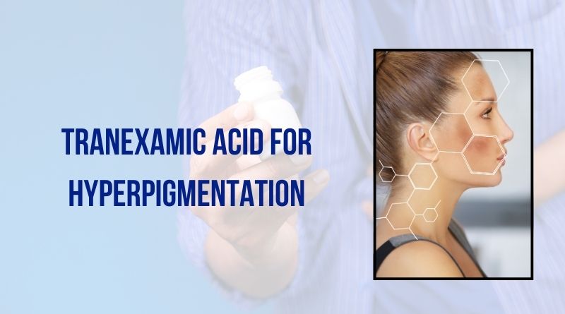 Tranexamic Acid For Hyperpigmentation