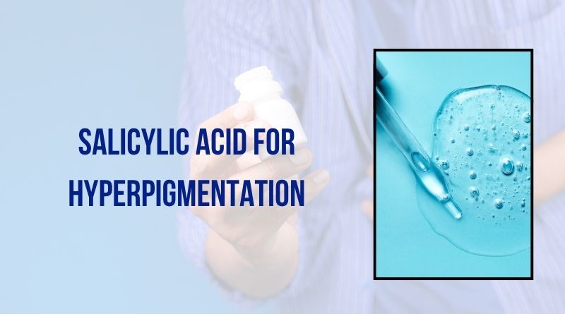 Salicylic Acid For Hyperpigmentation