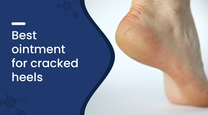 Best Ointment for Cracked Heels – Heal Dry, Painful Feet Fast