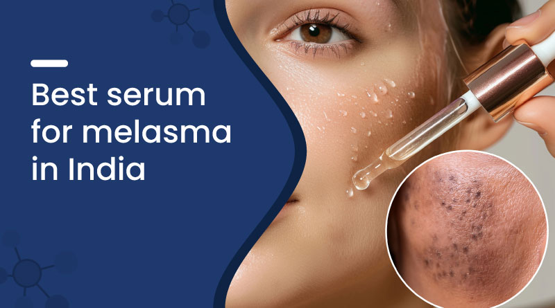 Best Serum for Melasma in India – Fade Dark Spots & Pigmentation