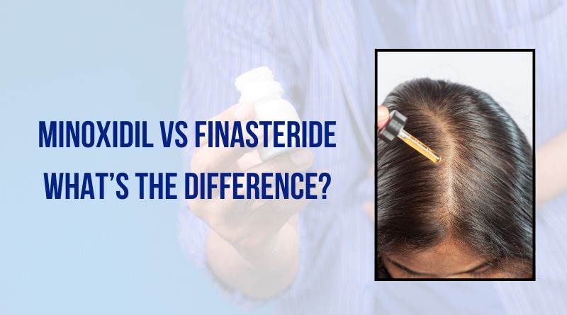 Minoxidil vs Finasteride