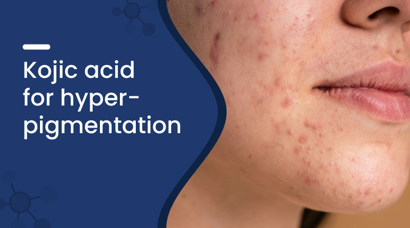 Kojic Acid For Hyperpigmentation