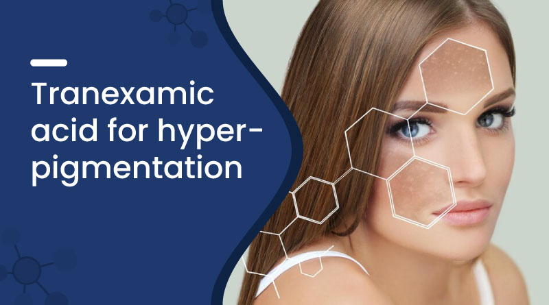 Tranexamic Acid For Hyperpigmentation