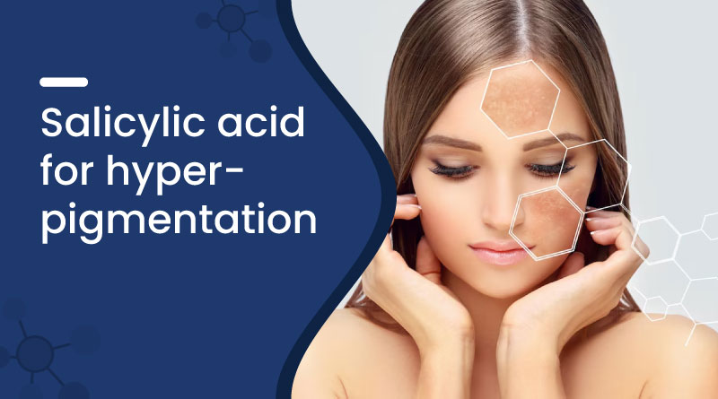 Salicylic Acid For Hyperpigmentation
