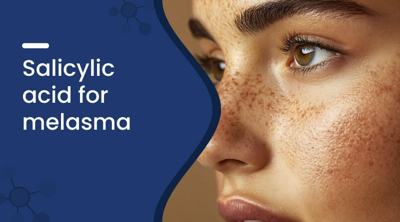 Salicylic Acid For Hyperpigmentation