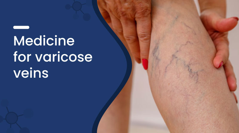 Medicine For Varicose Veins