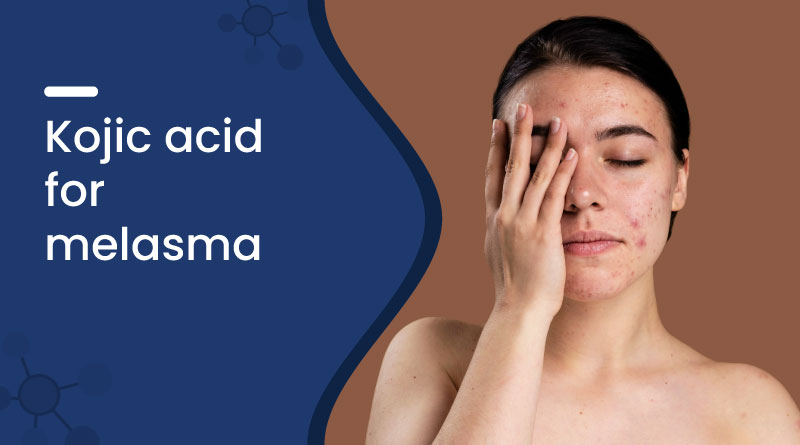 Kojic Acid For Melasma