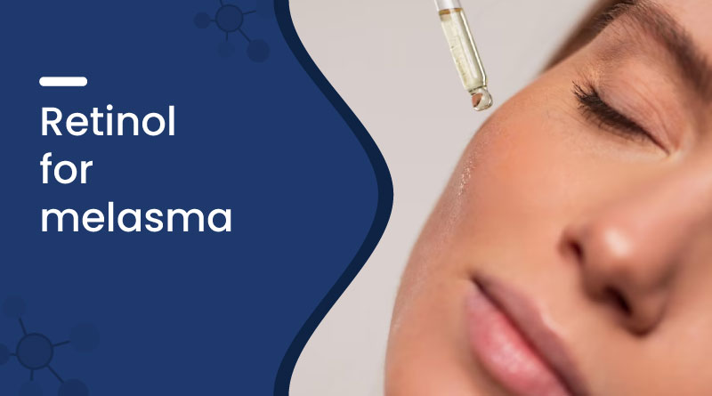 Retinol For Melasma
