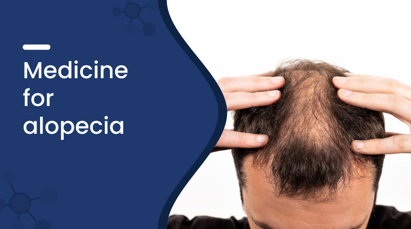 Medicine For Alopecia