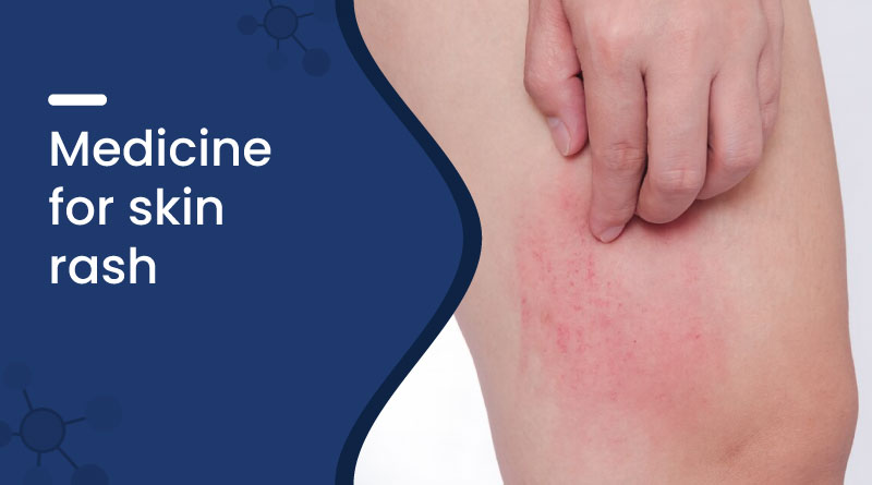 Medicine For Skin Rash