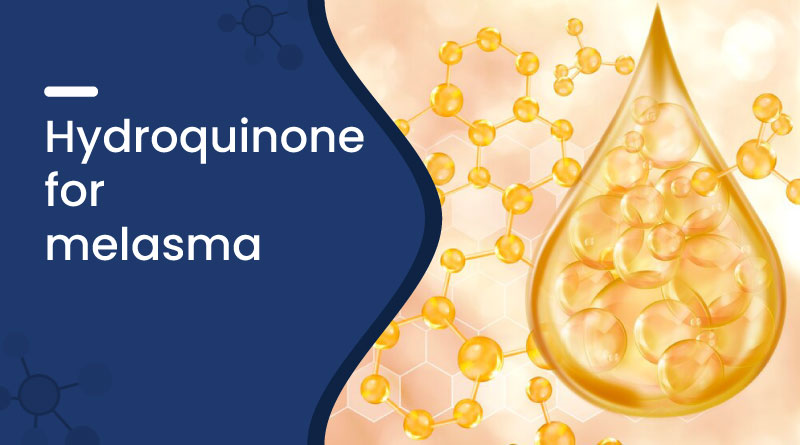 Hydroquinone For Melasma