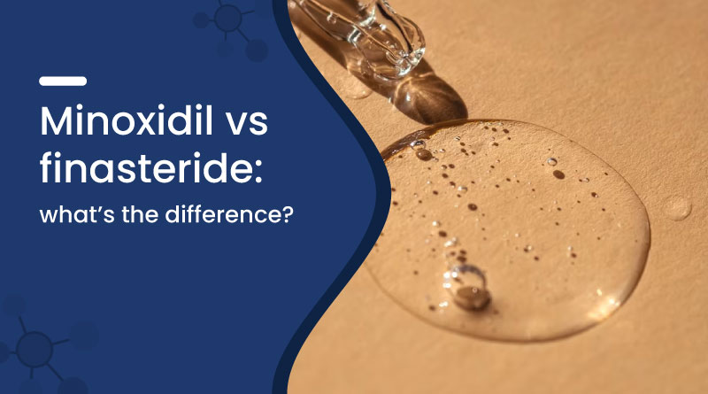 Minoxidil vs Finasteride