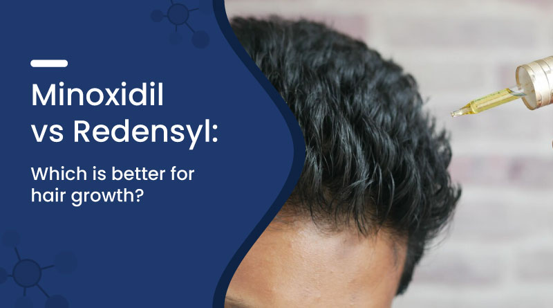 Minoxidil vs Redensyl