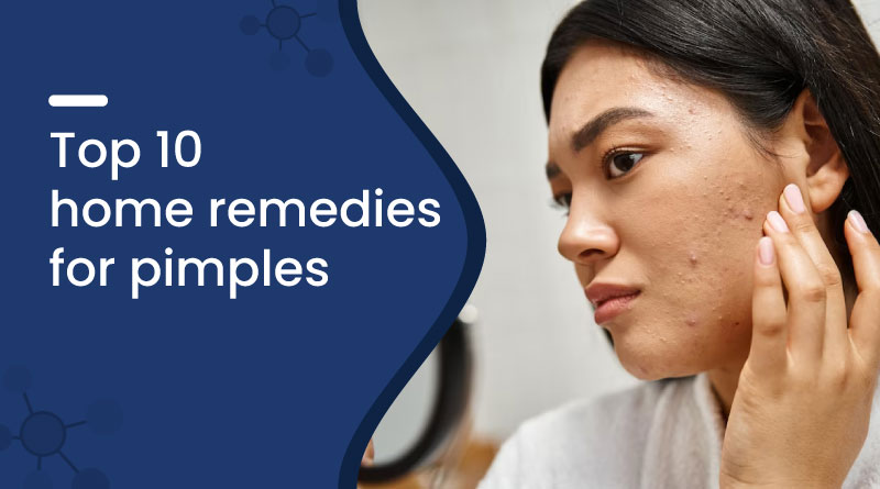 Top 10 Home Remedies for Pimples
