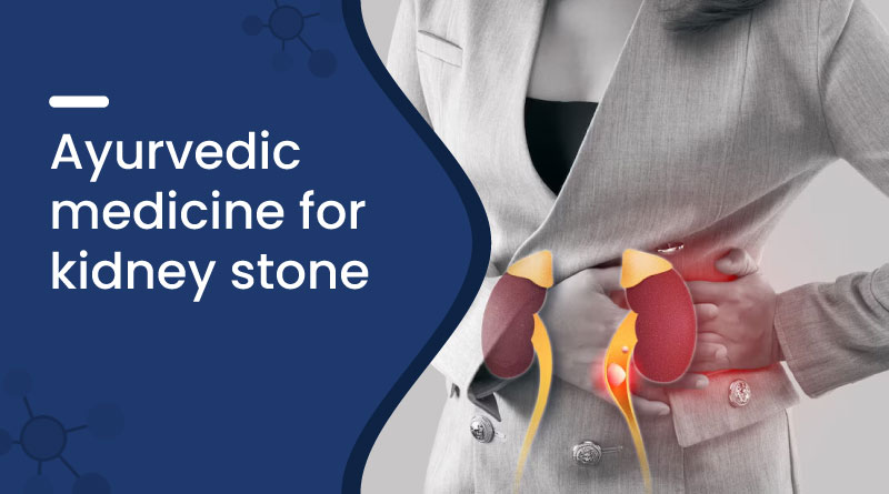 Ayurvedic Medicine for Kidney Stone​