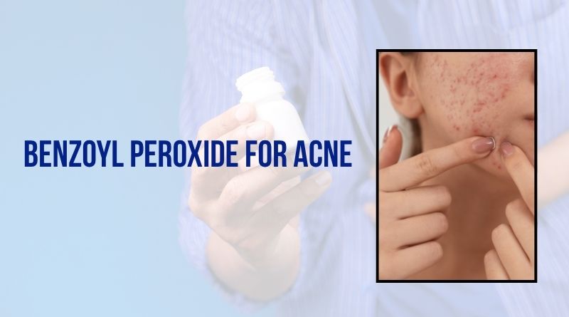 Benzoyl Peroxide For Acne