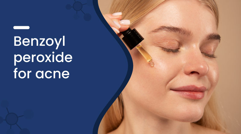 Benzoyl Peroxide For Acne