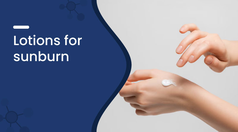 lotions-for-sunburn