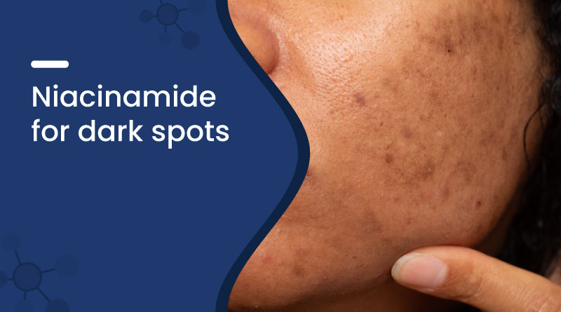 Niacinamide For Dark Spots