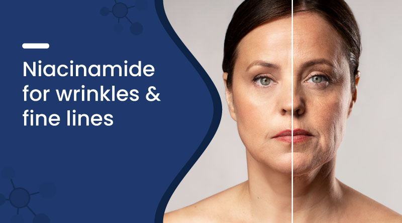 Niacinamide for Wrinkles & Fine Lines