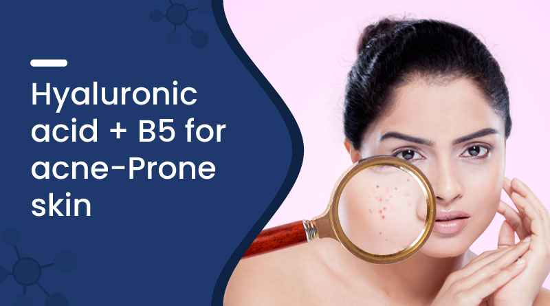 Is Hyaluronic Acid + B5 Safe for Acne-Prone Skin?