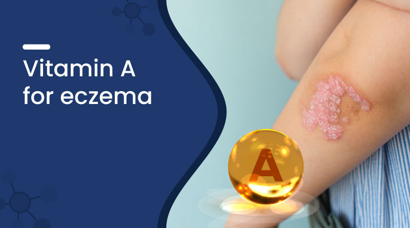 Vitamin A for Eczema – Benefits, Uses & Skin Healing Support
