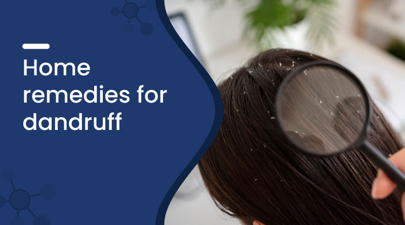 Home Remedies for Dandruff – Natural Ways to Get Flake-Free Hair