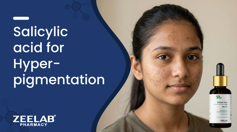Salicylic Acid For Hyperpigmentation