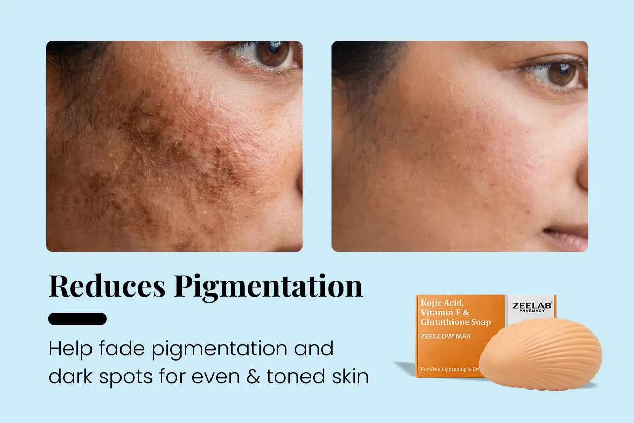 glutathione soap before and after Kojic Acid AOD-9604 – Priority Wellness Hayfecer Remedy mg:10mg/10mg X 3pk