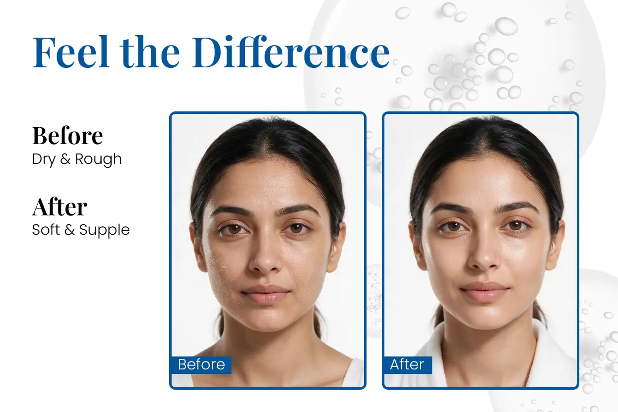 softy p cream before and after for dry skin