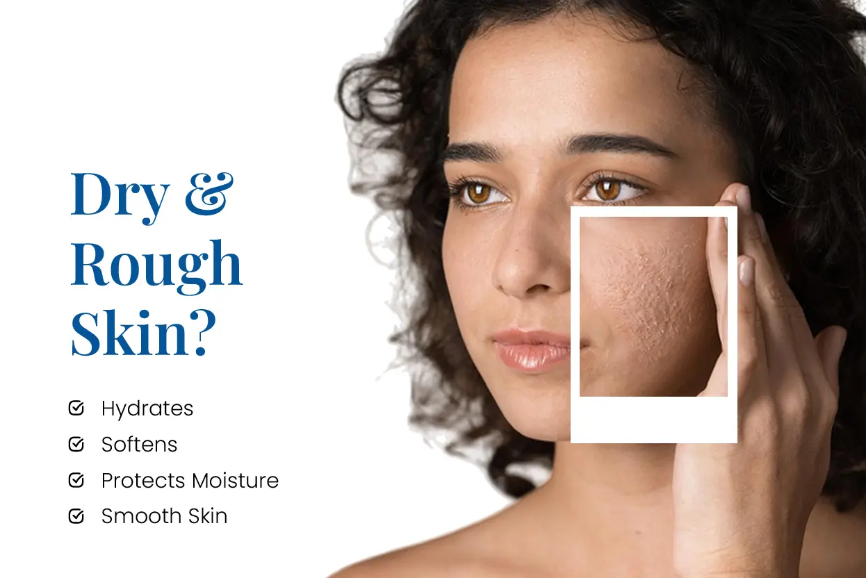 softy p cream for dry and rough skin