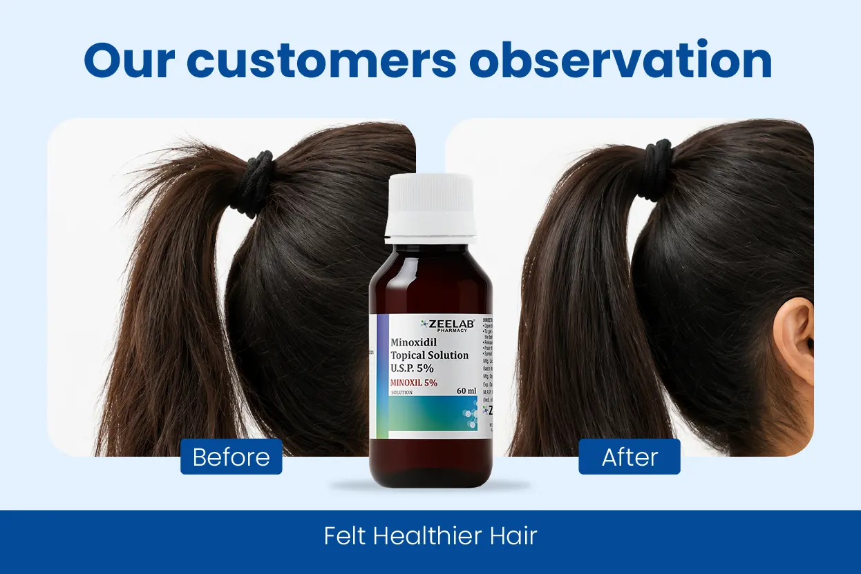 minoxil 5 solution for healthier and fuller looking hair