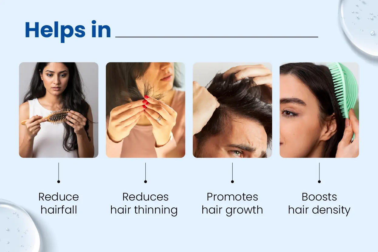 minoxil 5 solution helps reduce hair fall and thinning