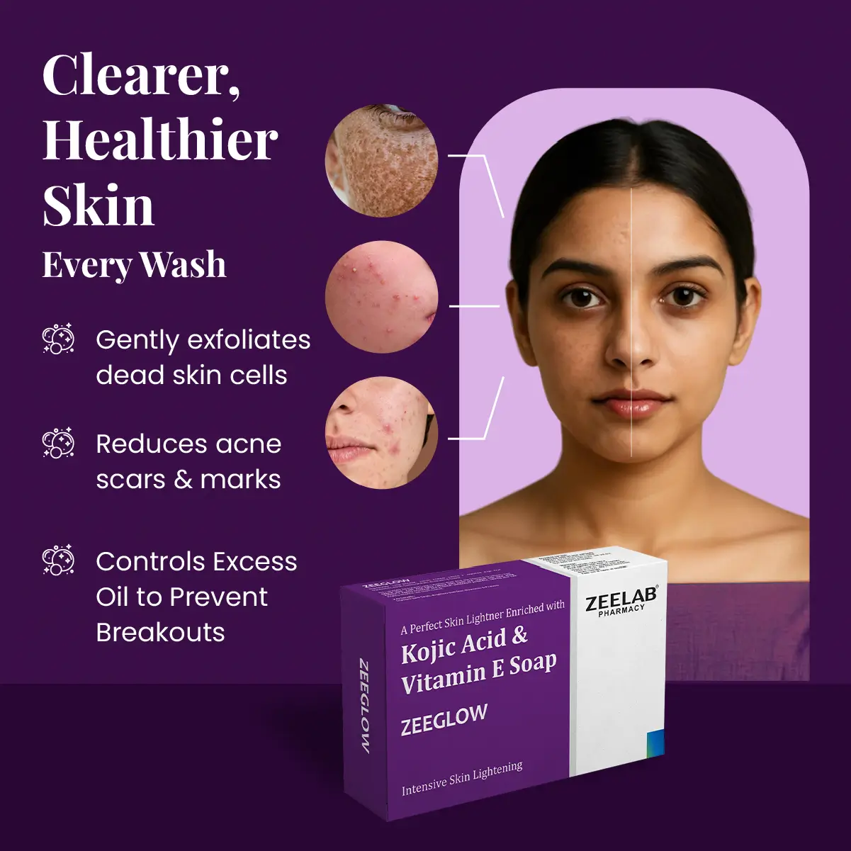 Kojic Acid and Vitamin E Soap For Skin Lightening and Hyperpigmentation