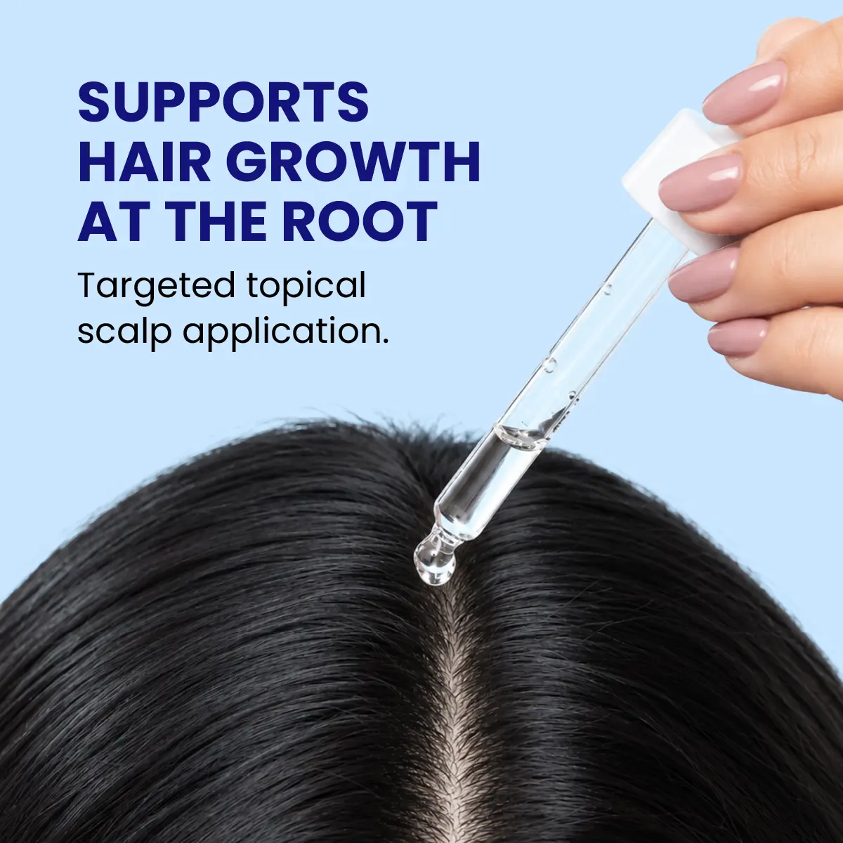 minoxil 2% topical solution for scalp application