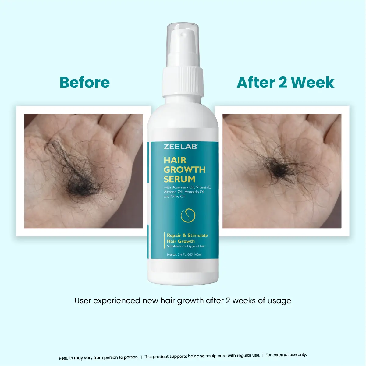 Zeelab Hair Growth Serum 100ml