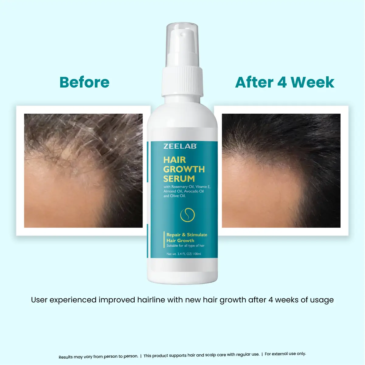 Zeelab Hair Growth Serum 100ml