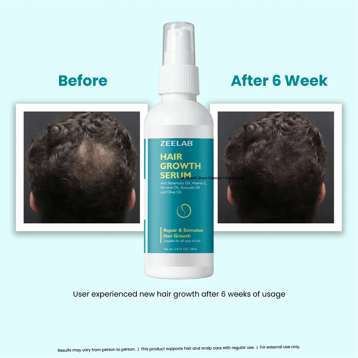 Zeelab Hair Growth Serum 100ml