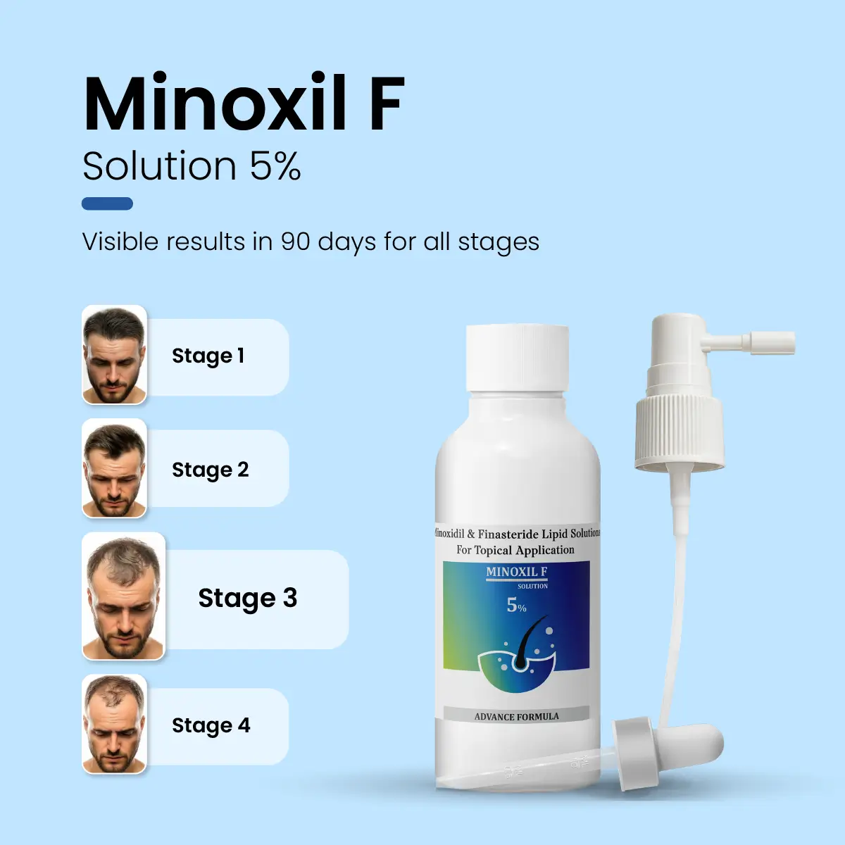 Minoxil F 5% Topical Solution | For Hair Growth
